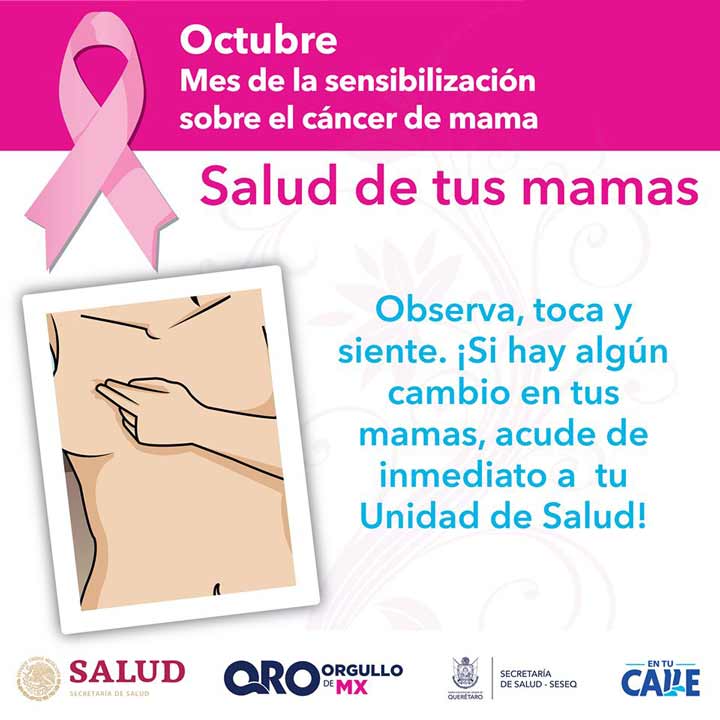 Autoexploración de mama, técnica de vital importancia para el diagnóstico temprano de cáncer