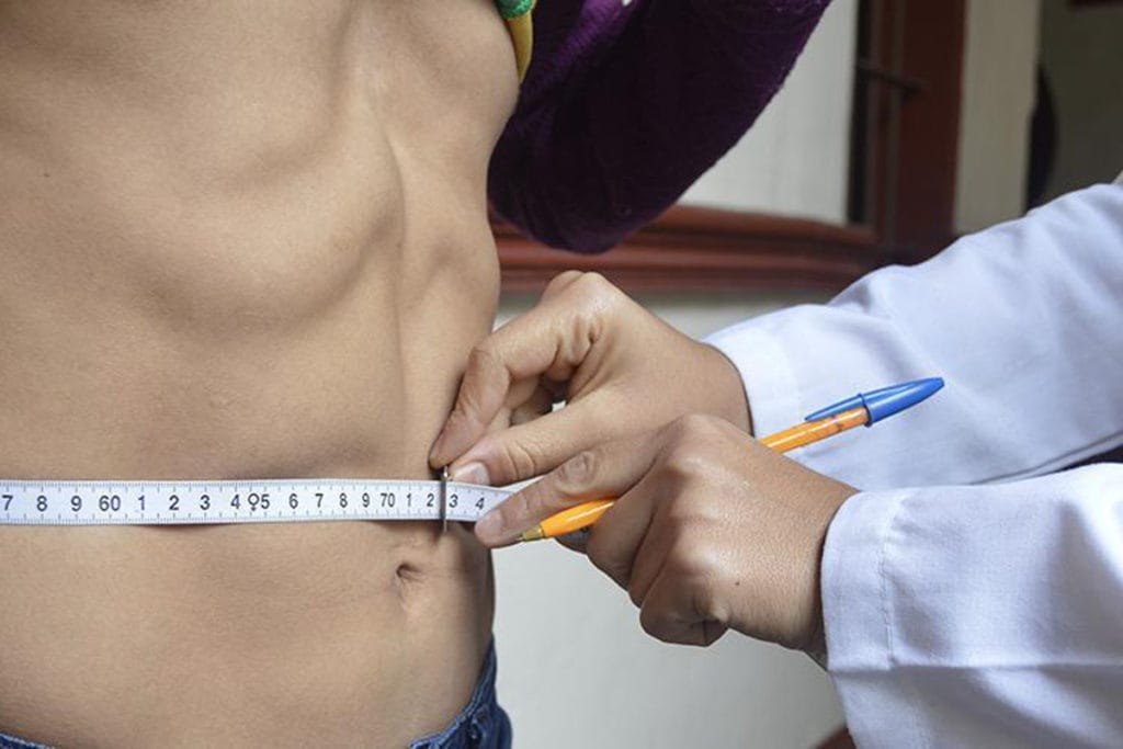 38.6% de las mujeres y 27.7% de hombres padecen obesidad en México