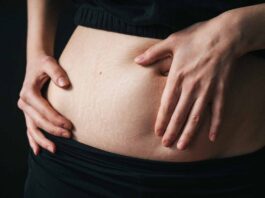 ¡Abdomen firme y sin estrías! Tu guía completa