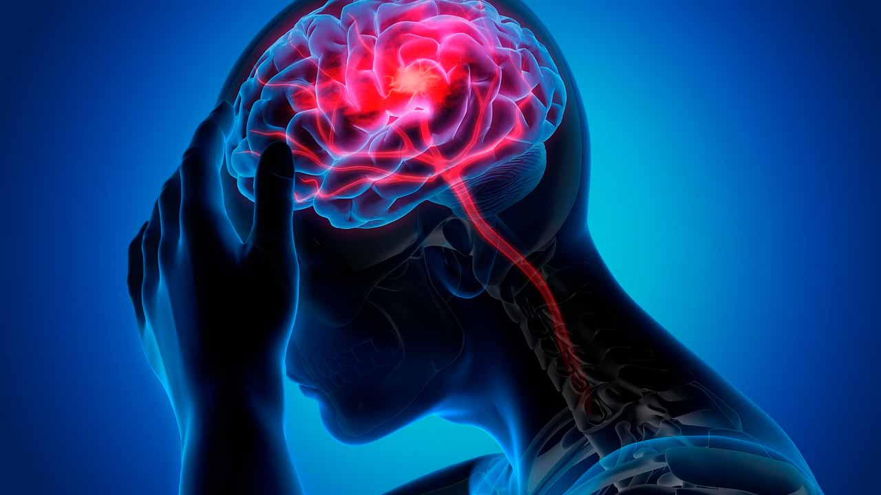Migraña: una condición que afecta la calidad de vida