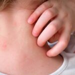 Establecen protocolo en escuelas de Querétaro por sarampión Establecen protocolo en escuelas de Querétaro por sarampión