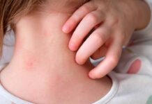 Menores de 1 a 9 años concentran más de 2 mil 400 contagios por sarampión en el país
Menores de 1 a 9 años concentran más de 2 mil 400 contagios por sarampión en el país